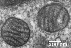 two mitochondria (electron micrograph)